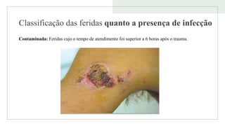Classificação das feridas quanto a presença de infecção
Contaminada: Feridas cujo o tempo de atendimento foi superior a 6 horas após o trauma.
 