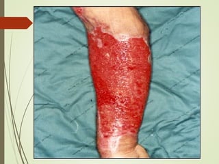 Comprehensive Overview of Skin Anatomy, Wound Types, and Healing ...