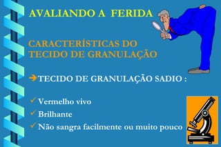 AVALIANDO A  FERIDA TECIDO DE GRANULAÇÃO SADIO : CARACTERÍSTICAS DO TECIDO DE GRANULAÇÃO Vermelho vivo Brilhante Não sangra facilmente ou muito pouco 