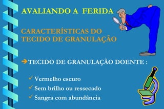 AVALIANDO A  FERIDA TECIDO DE GRANULAÇÃO DOENTE : CARACTERÍSTICAS DO TECIDO DE GRANULAÇÃO Vermelho escuro Sem brilho ou ressecado Sangra com abundância 
