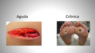 FERIDAS E CURATIVOS.pptx