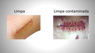 FERIDAS E CURATIVOS.pptx