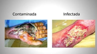 FERIDAS E CURATIVOS.pptx