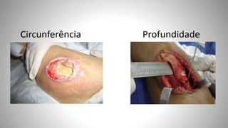 FERIDAS E CURATIVOS.pptx