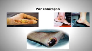 FERIDAS E CURATIVOS.pptx