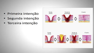 FERIDAS E CURATIVOS.pptx