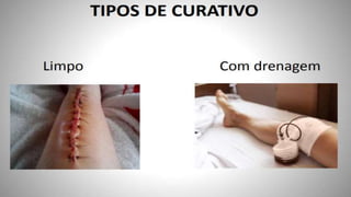 FERIDAS E CURATIVOS.pptx