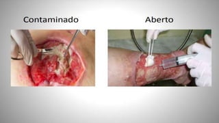 FERIDAS E CURATIVOS.pptx