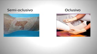 FERIDAS E CURATIVOS.pptx