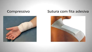 FERIDAS E CURATIVOS.pptx