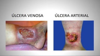 FERIDAS E CURATIVOS.pptx