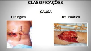 FERIDAS E CURATIVOS.pptx