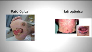 FERIDAS E CURATIVOS.pptx