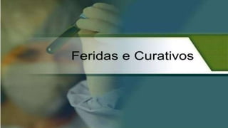 FERIDAS E CURATIVOS
 