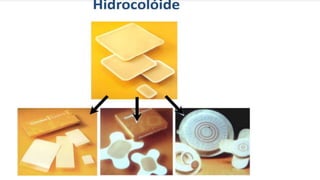 FERIDAS E CURATIVOS.pptx