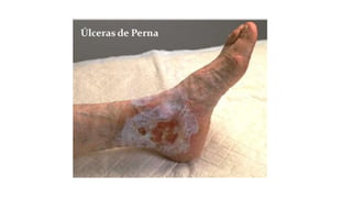 FERIDAS E CURATIVOS.pptx