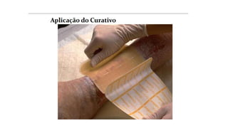 FERIDAS E CURATIVOS.pptx