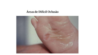 FERIDAS E CURATIVOS.pptx