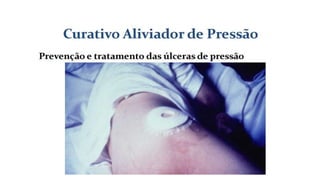 FERIDAS E CURATIVOS.pptx