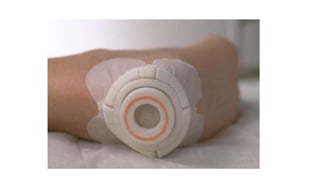 FERIDAS E CURATIVOS.pptx