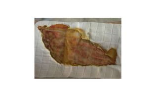 FERIDAS E CURATIVOS.pptx