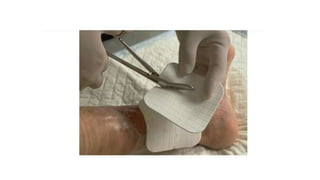 FERIDAS E CURATIVOS.pptx