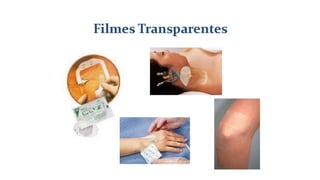 FERIDAS E CURATIVOS.pptx