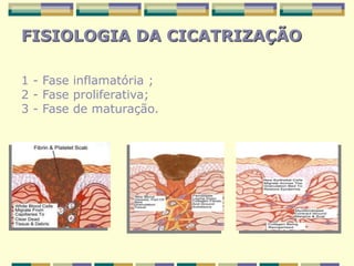 FISIOLOGIA DA CICATRIZAÇÃO
1 - Fase inflamatória ;
2 - Fase proliferativa;
3 - Fase de maturação.
 