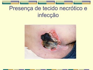 Presença de tecido necrótico e
infecção
 