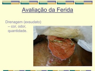 Avaliação da Ferida
Drenagem (exsudato)
– cor, odor,
quantidade.
 