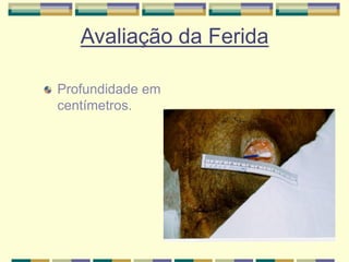 Profundidade em
centímetros.
Avaliação da Ferida
 