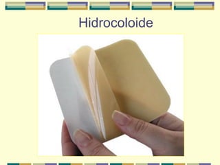 Hidrocoloide
 