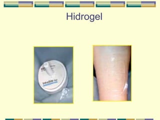 Hidrogel
 