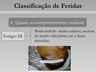Estágio III
Classificação de Feridas
4. Quanto ao comprometimento tecidual:
Perda total do tecido cutâneo, necrose
do tecido subcutâneo até a fáscia
muscular;
 