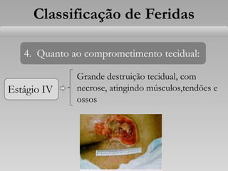Estágio IV
Classificação de Feridas
4. Quanto ao comprometimento tecidual:
Grande destruição tecidual, com
necrose, atingindo músculos,tendões e
ossos
 