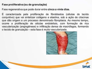 Fase proliferativa(ou de granulação)
Fase regenerativa que pode durar entre cinco a vinte dias.
É caracterizada pela proliferação de fibroblastos (células do tecido
conjuntivo) que vai sintetizar colágeno e elastina, sob a ação de citocinas
que dão origem a um processo denominado fibroplasia. Ao mesmo tempo,
ocorre a proliferação de células endoteliais, com formação de rica
vascularização (angiogênese) e infiltração densa de macrófagos, formando
o tecido de granulação – esta fase é muito vascularizada.
 