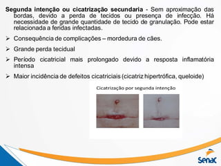 Segunda intenção ou cicatrização secundaria - Sem aproximação das
bordas, devido a perda de tecidos ou presença de infecção. Há
necessidade de grande quantidade de tecido de granulação. Pode estar
relacionada a feridas infectadas.
 Consequência de complicações – mordedura de cães.
 Grande perda tecidual
 Período cicatricial mais prolongado devido a resposta inflamatória
intensa
 Maior incidência de defeitos cicatriciais (cicatriz hipertrófica, queloide)
 