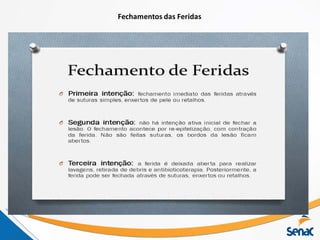 Fechamentos das Feridas
Tipos de Cicatrização
 