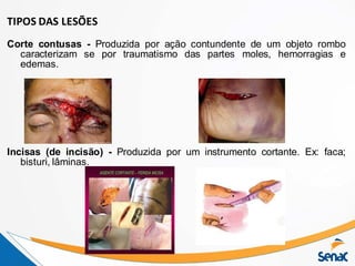 TIPOS DAS LESÕES
Corte contusas - Produzida por ação contundente de um objeto rombo
caracterizam se por traumatismo das partes moles, hemorragias e
edemas.
Incisas (de incisão) - Produzida por um instrumento cortante. Ex: faca;
bisturi, lâminas.
 