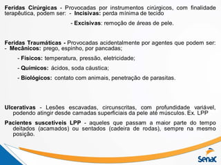 Feridas Cirúrgicas - Provocadas por instrumentos cirúrgicos, com finalidade
terapêutica, podem ser: - Incisivas: perda mínima de tecido
- Excisivas: remoção de áreas de pele.
Feridas Traumáticas - Provocadas acidentalmente por agentes que podem ser:
- Mecânicos: prego, espinho, por pancadas;
- Físicos: temperatura, pressão, eletricidade;
- Químicos: ácidos, soda cáustica;
- Biológicos: contato com animais, penetração de parasitas.
Ulcerativas - Lesões escavadas, circunscritas, com profundidade variável,
podendo atingir desde camadas superficiais da pele até músculos. Ex. LPP
Pacientes suscetíveis LPP - aqueles que passam a maior parte do tempo
deitados (acamados) ou sentados (cadeira de rodas), sempre na mesmo
posição.
 