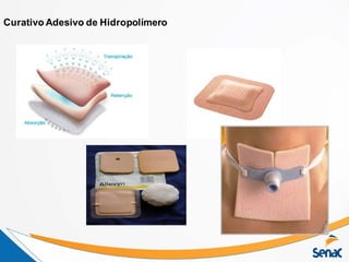 Curativo Adesivo de Hidropolímero
 