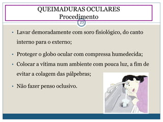• Lavar demoradamente com soro fisiológico, do canto
interno para o externo;
• Proteger o globo ocular com compressa humedecida;
• Colocar a vítima num ambiente com pouca luz, a fim de
evitar a colagem das pálpebras;
• Não fazer penso oclusivo.
QUEIMADURAS OCULARES
Procedimento
23
 