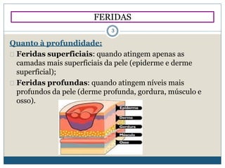 Quanto à profundidade:
Feridas superficiais: quando atingem apenas as
camadas mais superficiais da pele (epiderme e derme
superficial);
Feridas profundas: quando atingem níveis mais
profundos da pele (derme profunda, gordura, músculo e
osso).
FERIDAS
3
 
