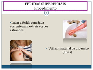 •Lavar a ferida com água
corrente para extrair corpos
estranhos
• Utilizar material de uso único
(luvas)
FERIDAS SUPERFICIAIS
Procedimento
5
 