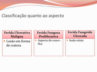Classificação quanto ao aspecto
Ferida Ulcerativa
Maligna
Ferida Fungosa
Proliferativa
 lesão mista Aspecto de couve -
flor
 Lesão em forma
de cratera
Ferida Fungoide
Ulcerada
 