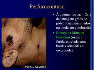 Perfurocontuso
• À queima-roupa: Orla
de tatuagem grãos de
pólvora não queimados
ou ainda em combustão
• Buraco da Mina de
Hofmann (ósseo )
ferida estrelada com
bordas solapadas e
escurecidas
 