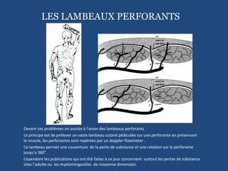 Devant ces problèmes on assiste à l’essor des lambeaux perforants Le principe est de prélever un vaste lambeau cutané pédiculée sur une perforante en préservant le muscle, les perforantes sont repérées par un doppler flowmeter . Ce lambeau permet une couverture  de la perte de substance et une rotation sur la perforante jusqu’a 360°. Cependant les publications qui ont été faites à ce jour concernent  surtout les pertes de substance chez l’adulte ou  les myelomingocèles  de moyenne dimension. LES LAMBEAUX PERFORANTS 