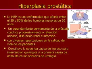 La HBP es una enfermedad que afecta entre el 50 y 80% de los hombres mayores de 50 años. Un agrandamiento permanente de la próstata conduce progresivamente a retención urinaria, disfunción renal e infección. con diversas repercusiones en la calidad de vida de los pacientes. Constituye la segunda causa de ingreso para intervención quirúrgica y la primera causa de consulta en los servicios de urología  Hiperplasia prostática 