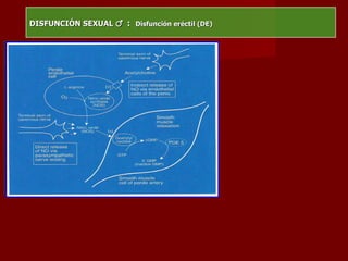 DISFUNCIÓN SEXUAL  ♂   :  Disfunción eréctil (DE) 