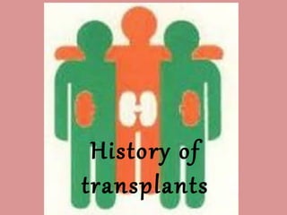 History of
transplants
 